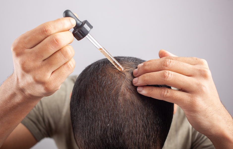 The Dos and Don'ts of Applying Minoxidil: Tips for Optimal Results