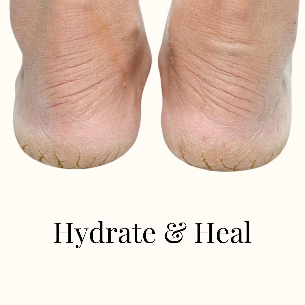FOOT REPAIR CREAM - Main Image